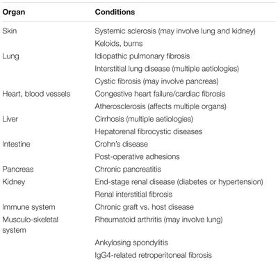 Cell-Based Therapies for Tissue Fibrosis